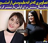 تغییر چهره عجیب ترانه علیدوستی بعد از بیماری ناشناخته اش/عکس